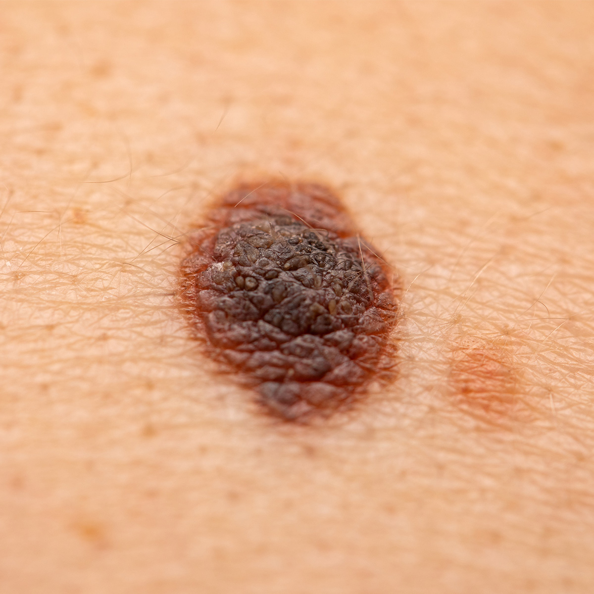 성북동피부과 06.jpg