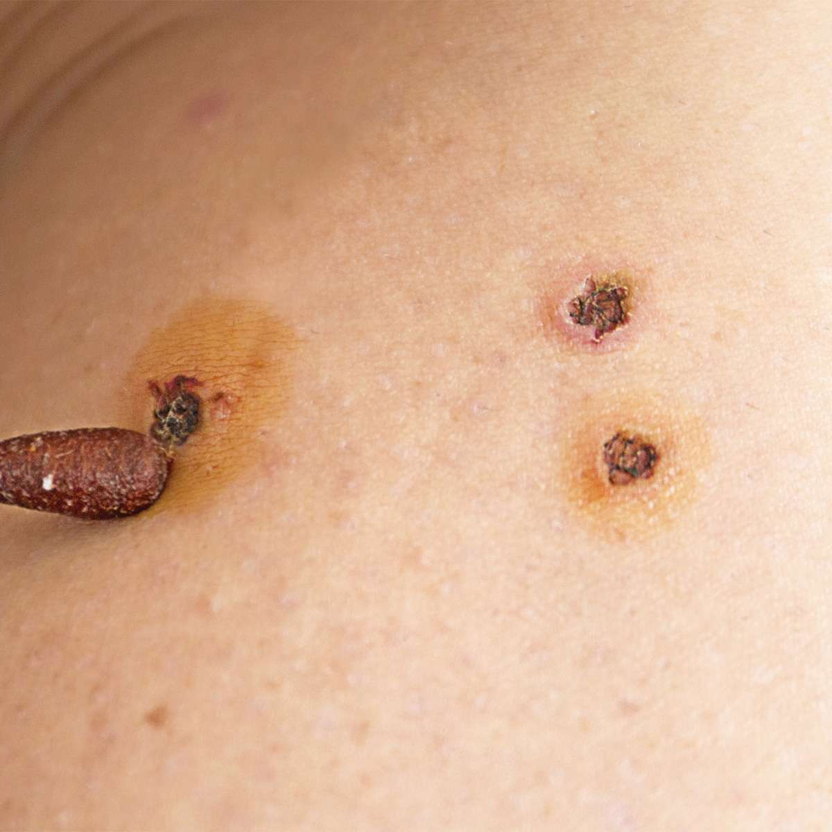 성북동피부과 09.jpg