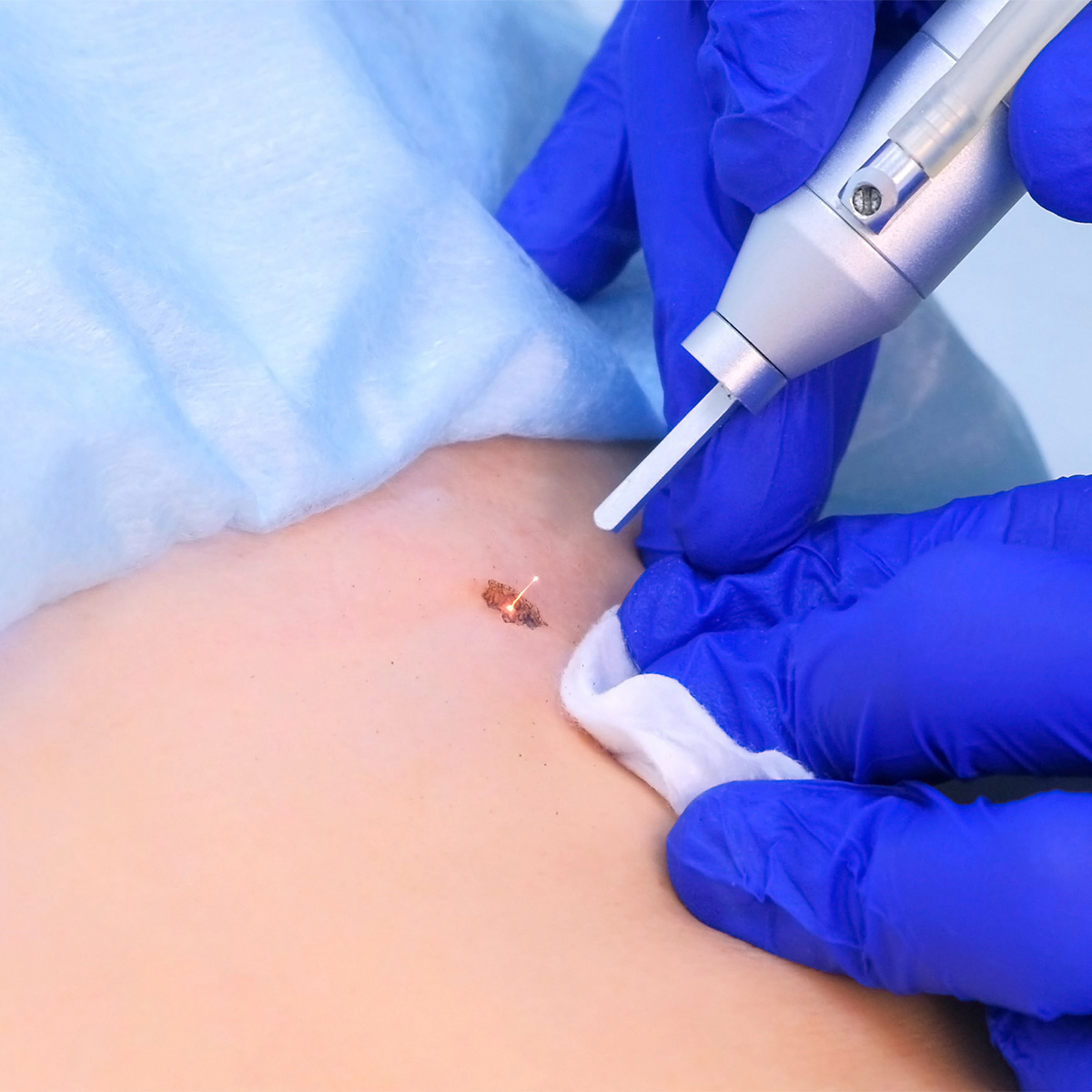 성북동피부과 04.jpg