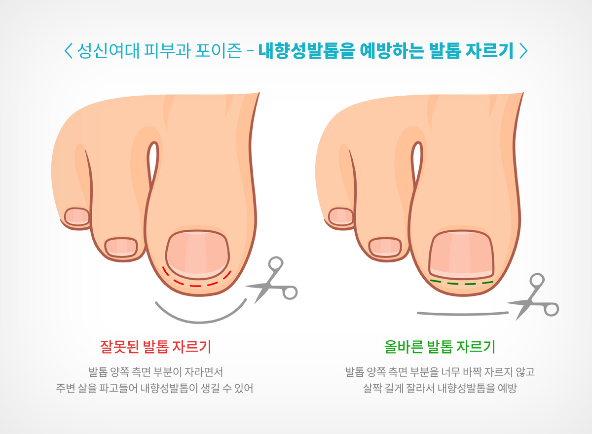 성신여대피부과 f64.jpg