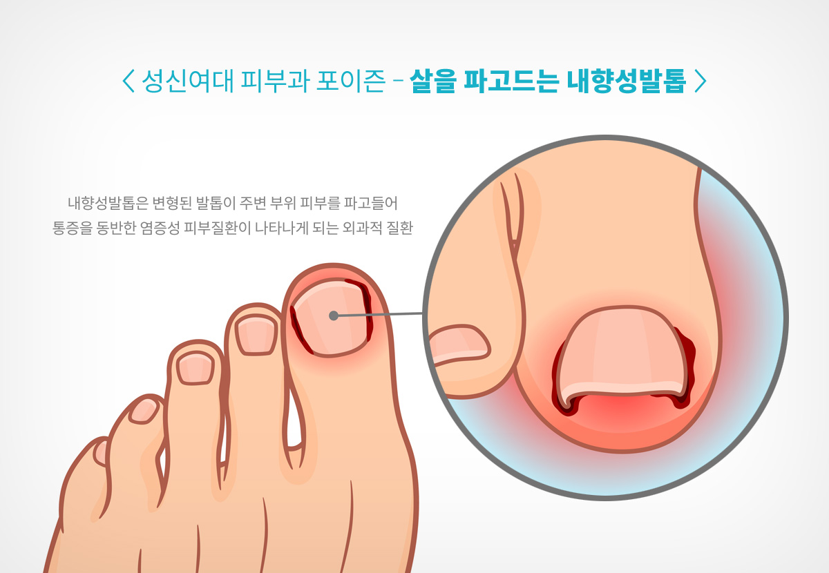 성신여대피부과 f51.jpg