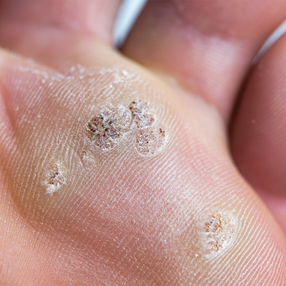 성신여대역피부과 11.jpg