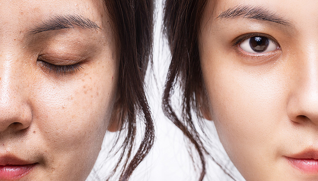 정릉역피부과 10.jpg