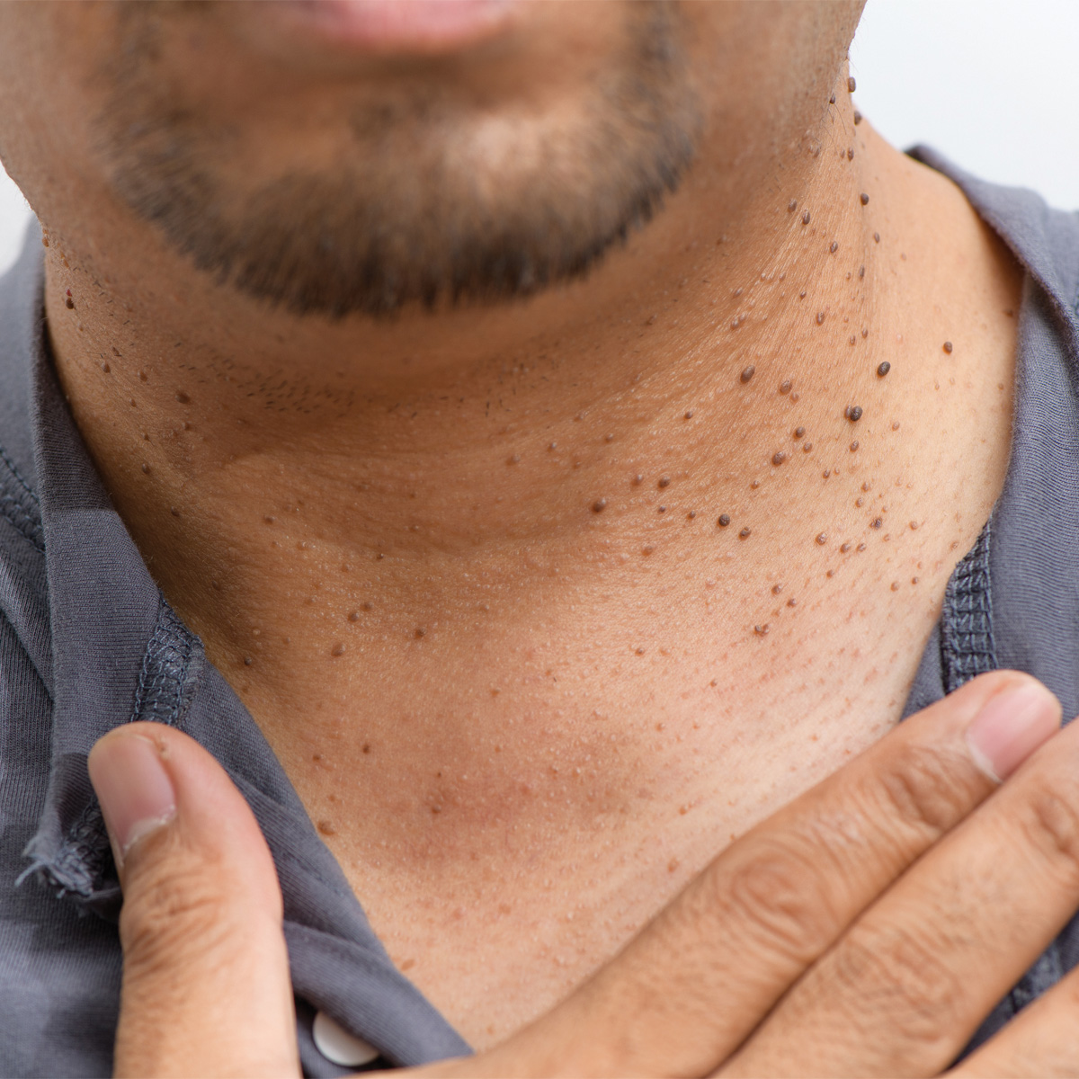 동소문동 피부과 04.jpg