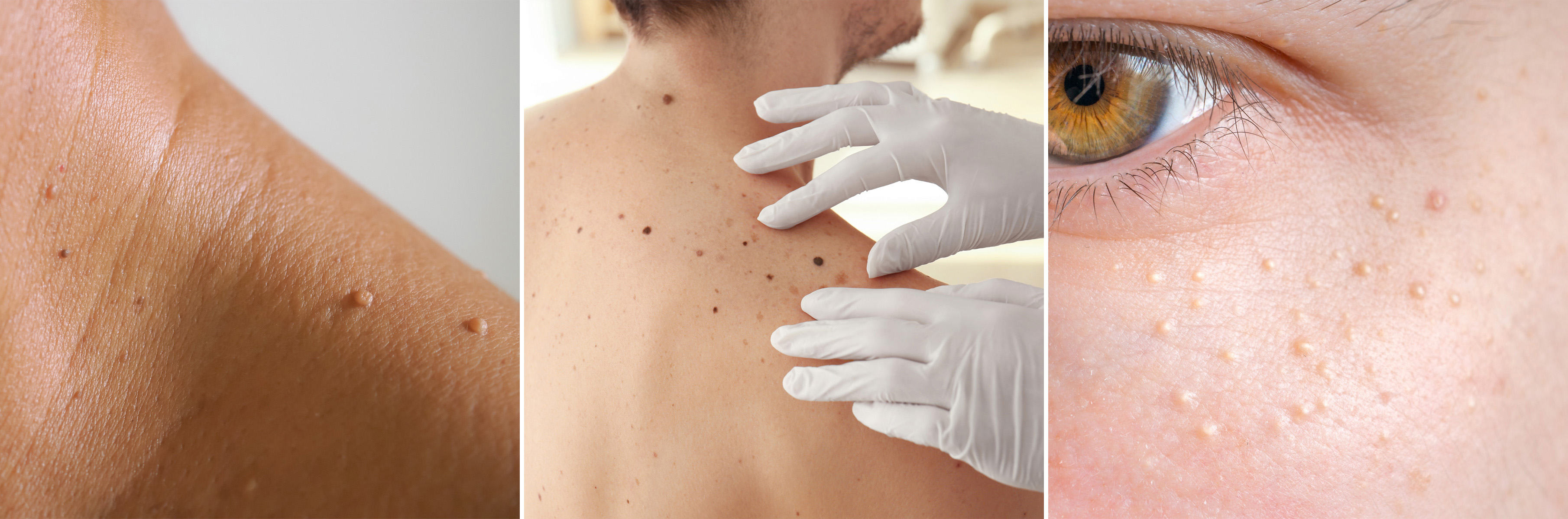 동소문동 피부과 09.jpg