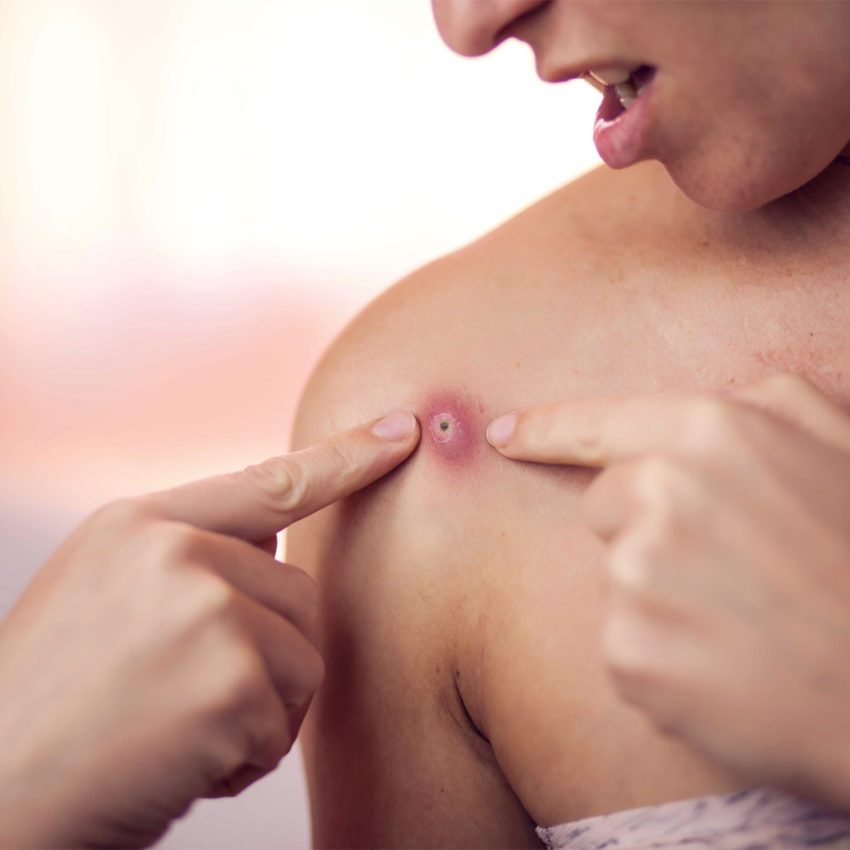 동소문동 피부과 03.jpg