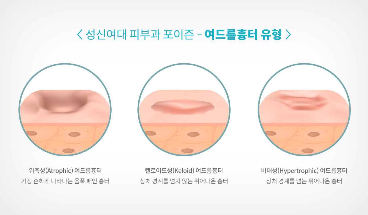 정릉동피부과 06.jpg