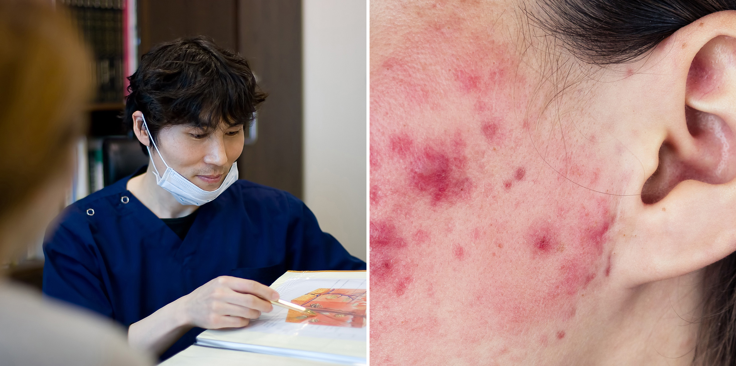 혜화역 피부과 02.jpg