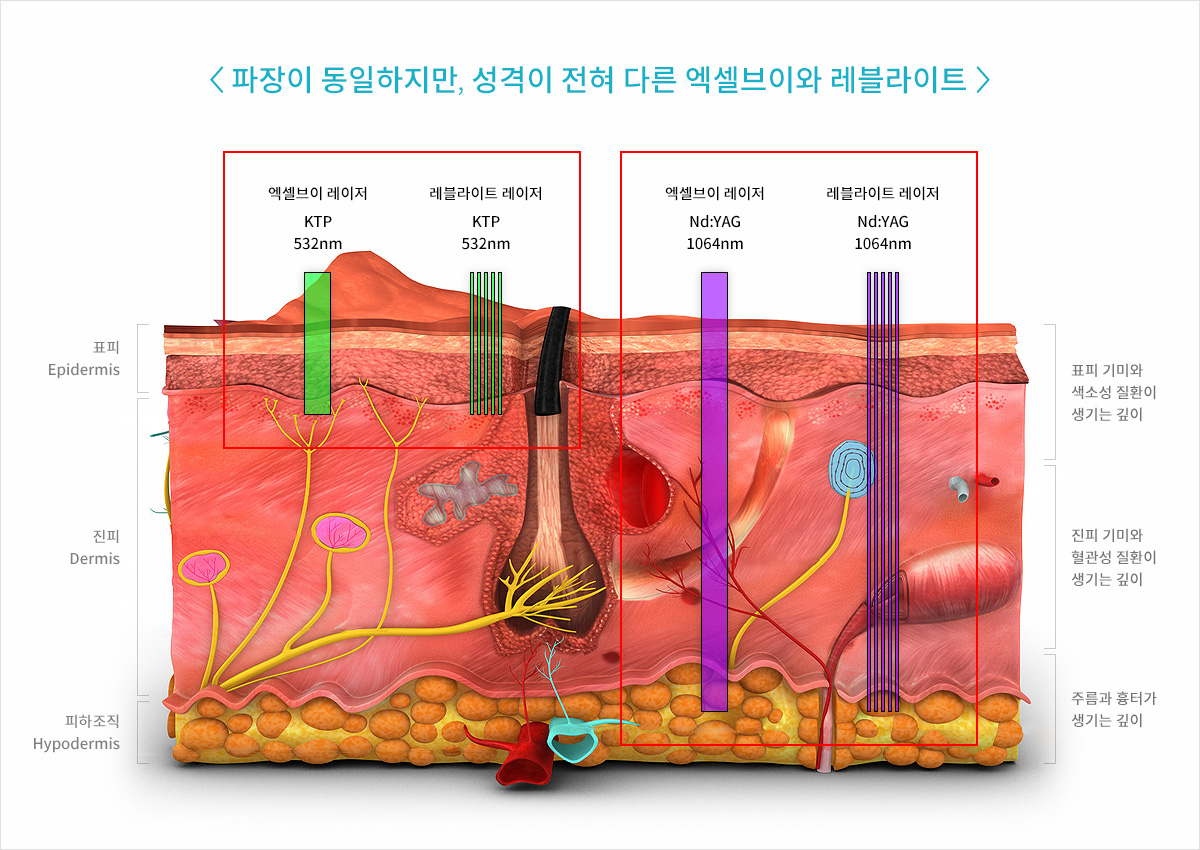 혜화역 피부과 04.jpg