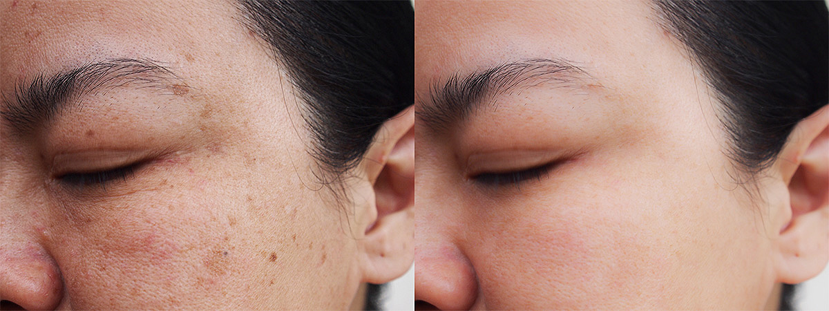 성신여대입구역 피부과 02.jpg