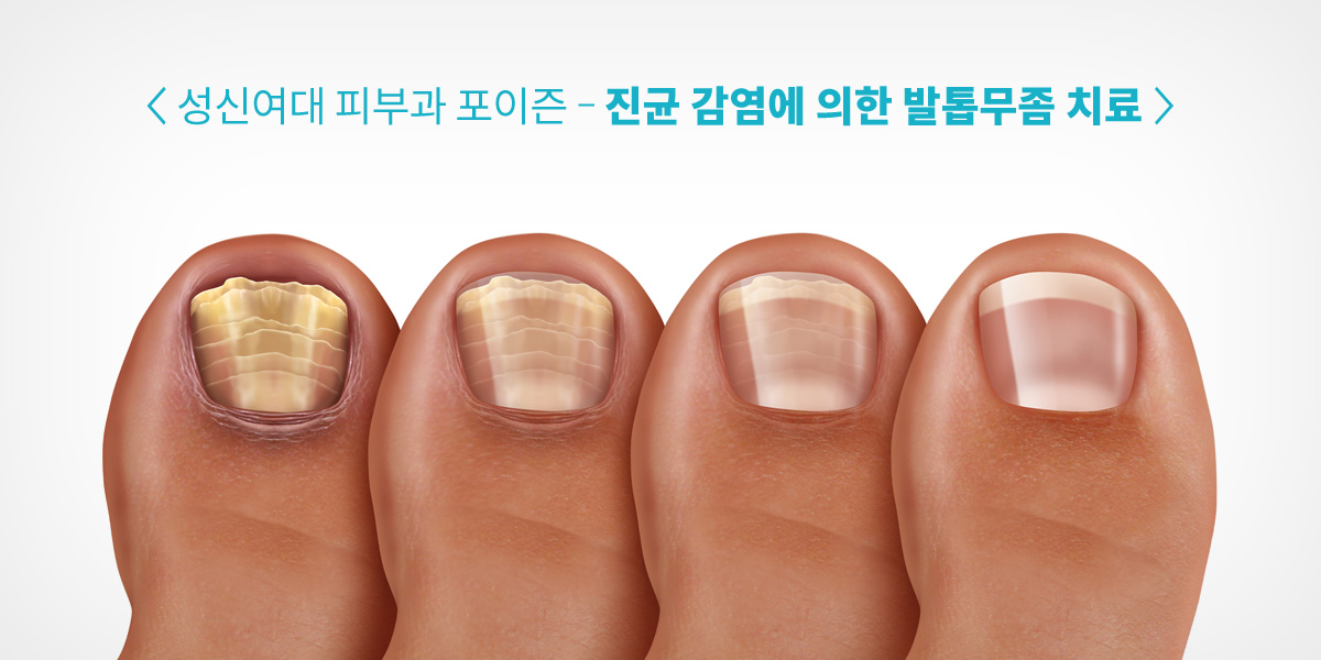 성신여대입구역피부과 12.jpg