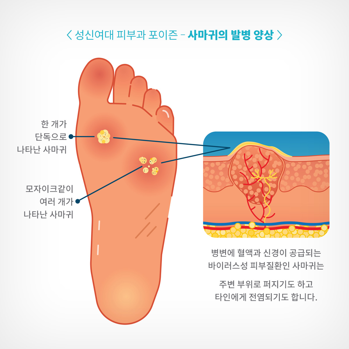 고려대 피부과 13.jpg
