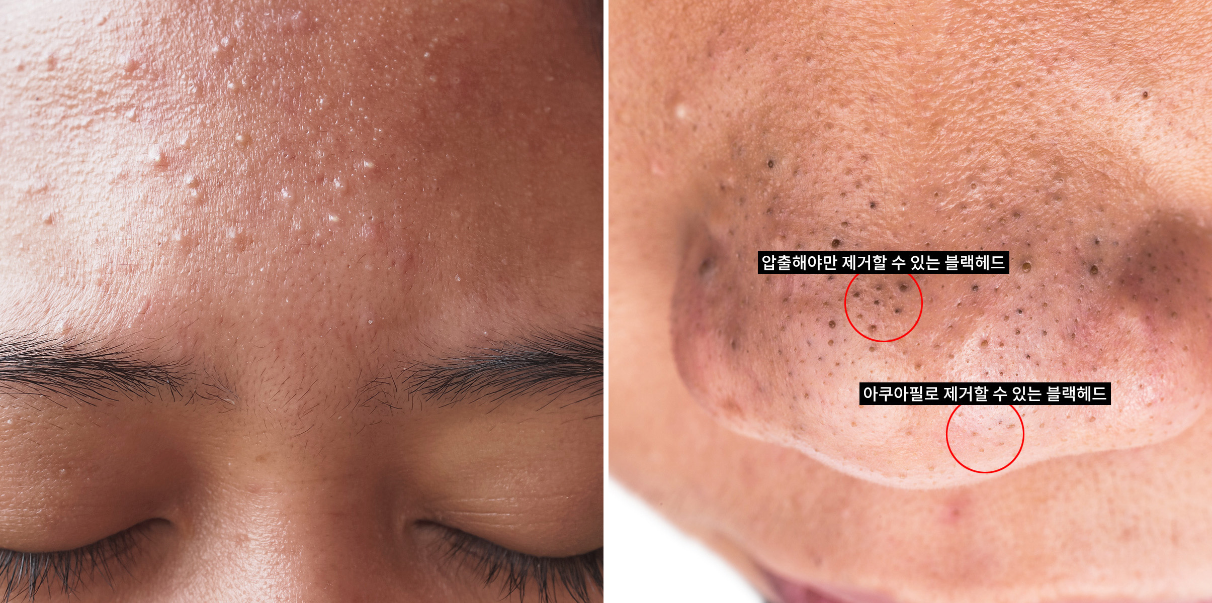 정릉피부과 04.jpg