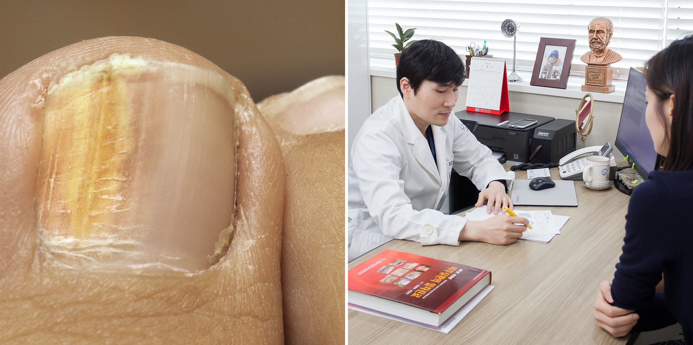 성북구 성신여대 피부과 무좀 (15).jpg