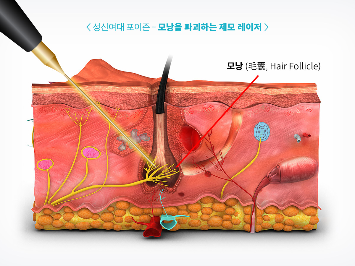 성북동 피부과 10.jpg
