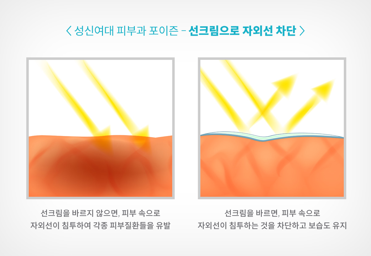 정릉역 피부과 07.jpg