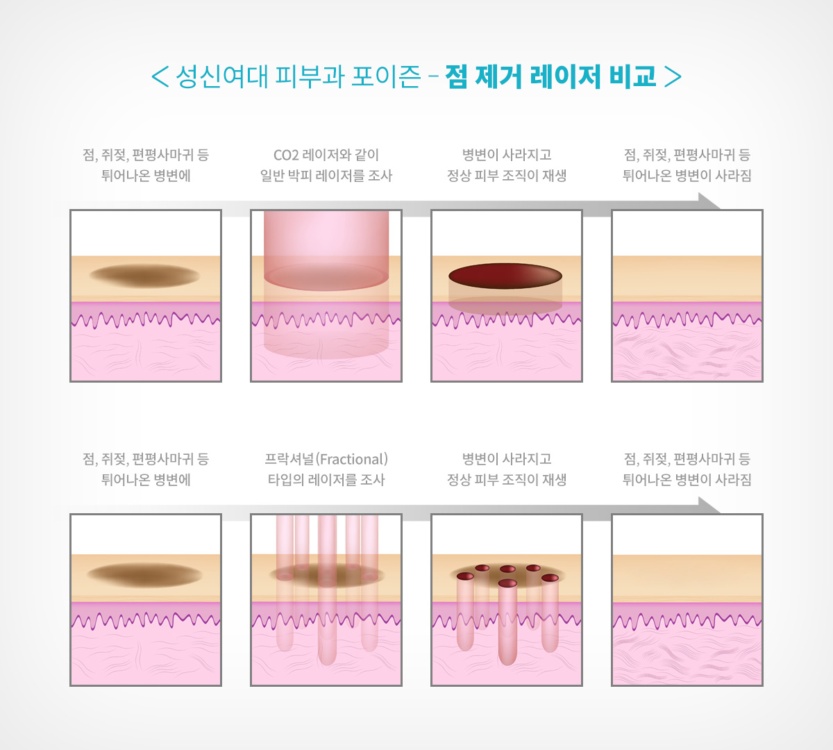 성신여대입구역피부과 11.jpg