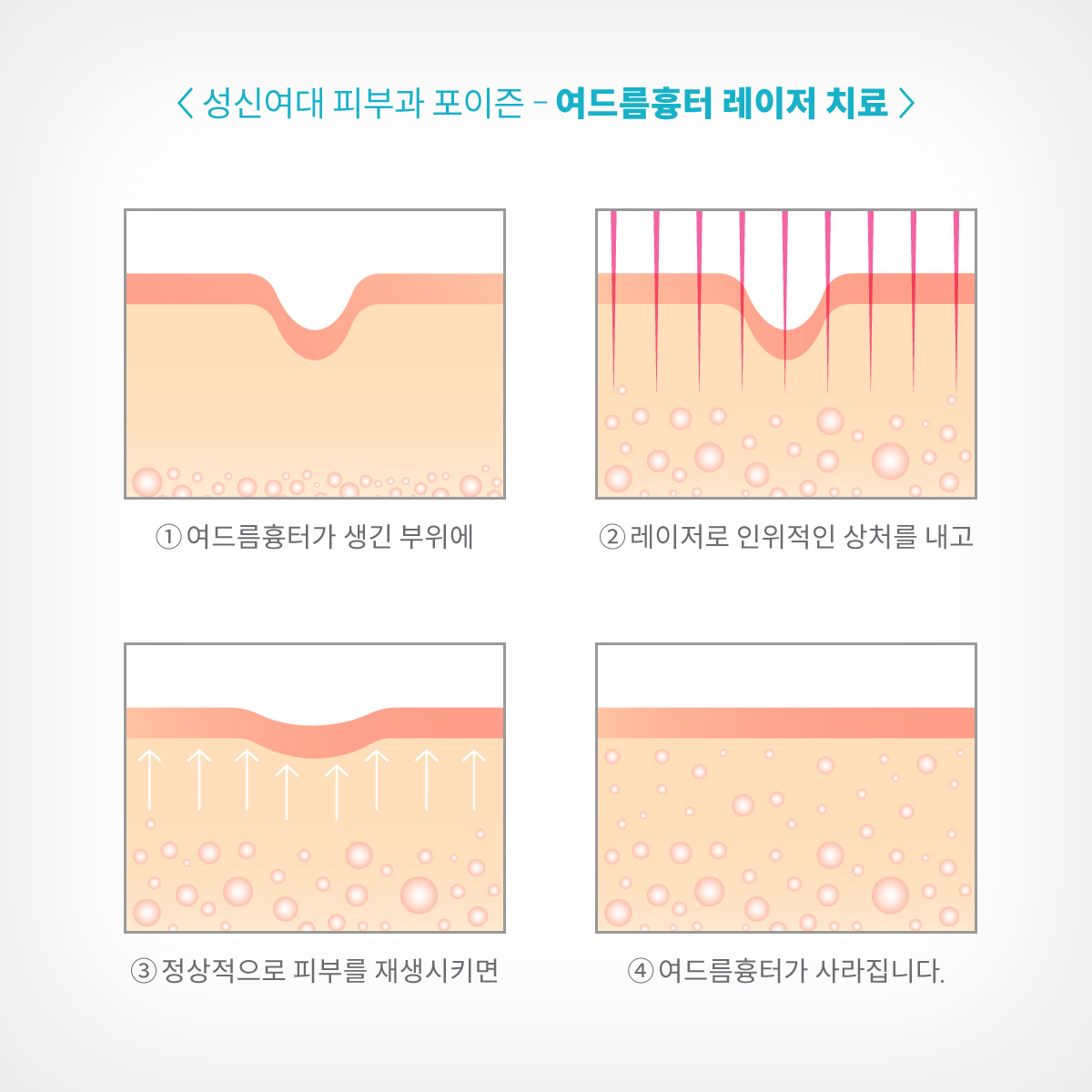 성신여대입구역피부과 08.jpg