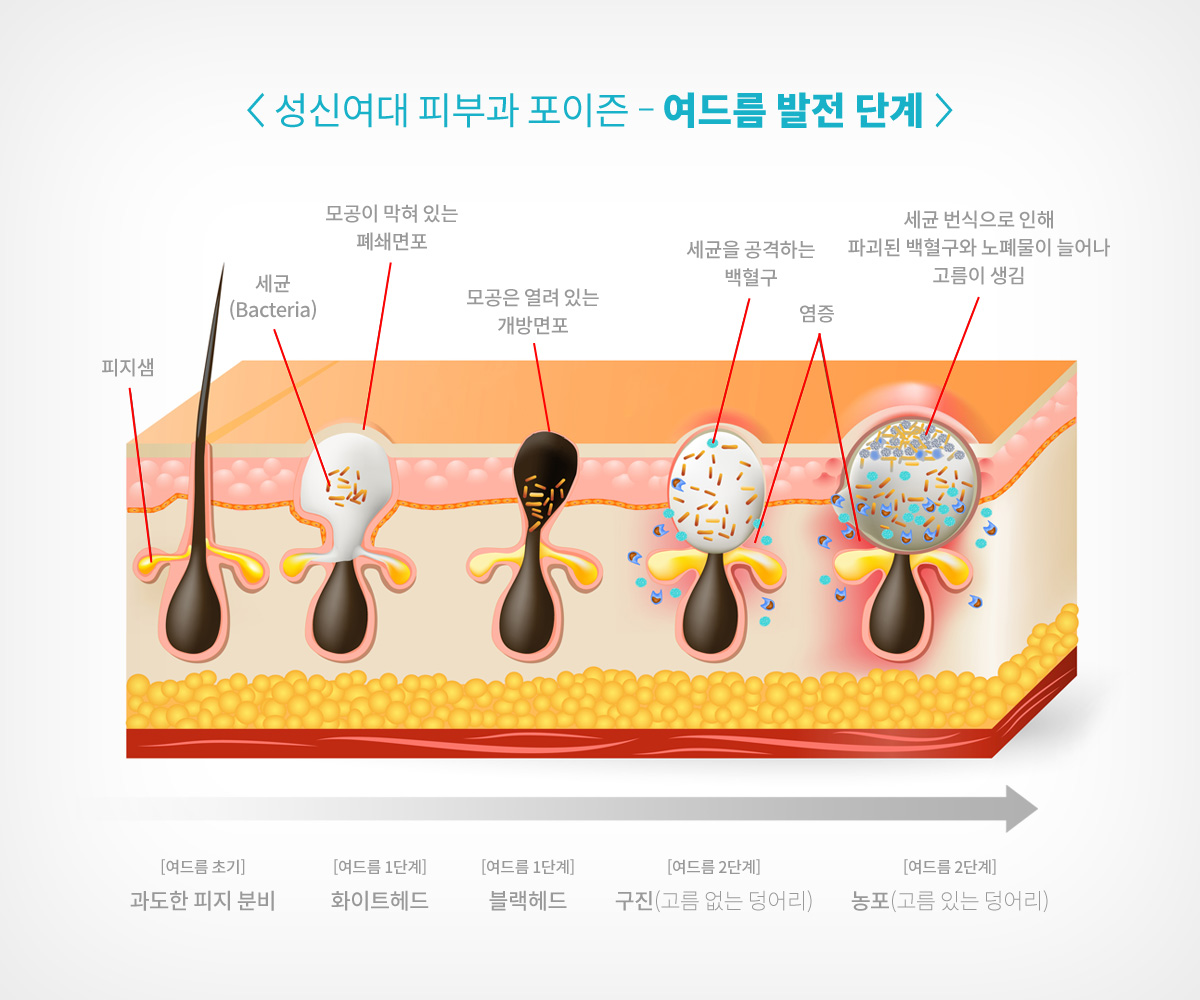 성신여대입구역피부과 03.jpg