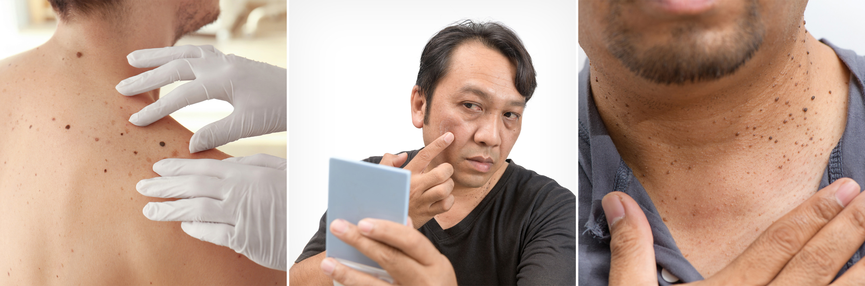 대학로피부과 01.jpg