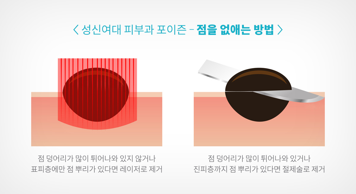 성신여대역 피부과 10.jpg