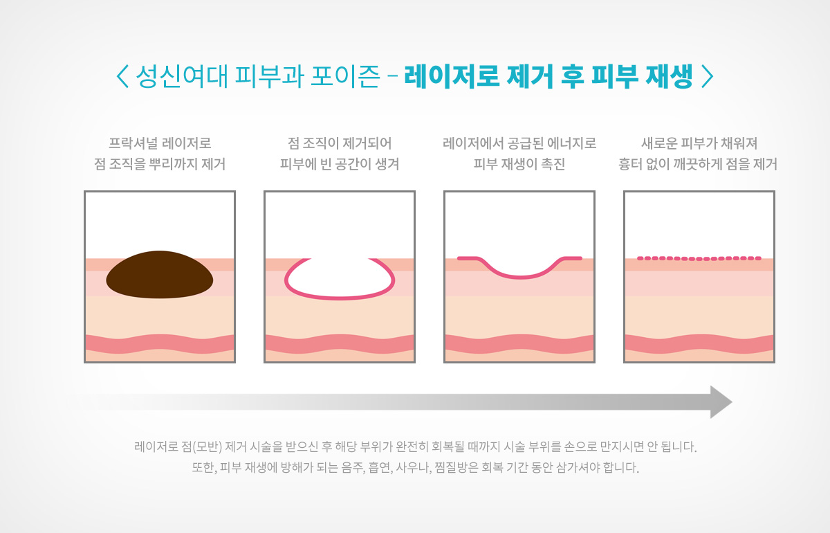 성신여대역 피부과 12.jpg