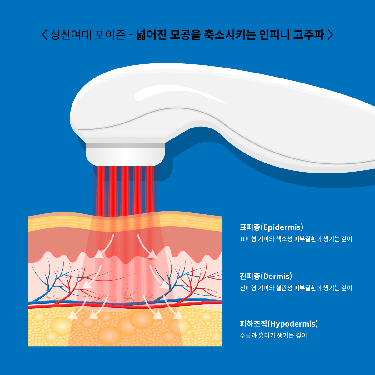 고려대 피부과 11.jpg