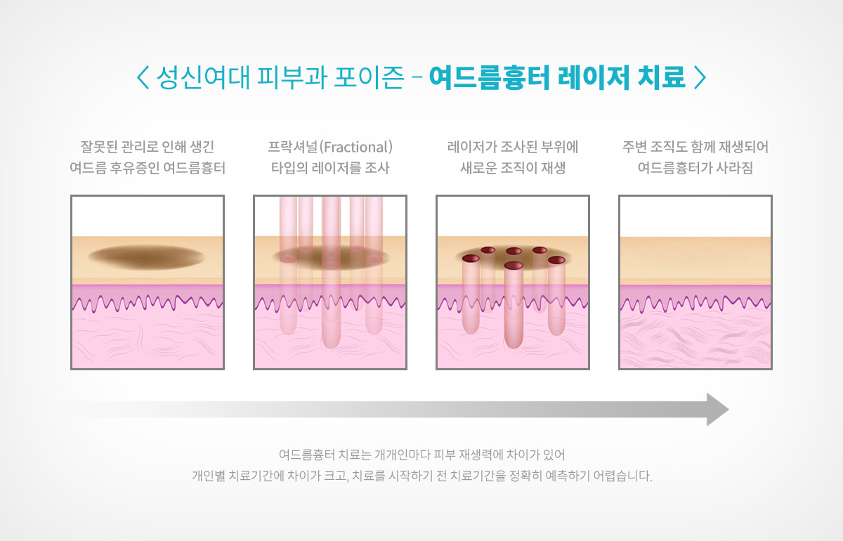성신여대역피부과 08.jpg