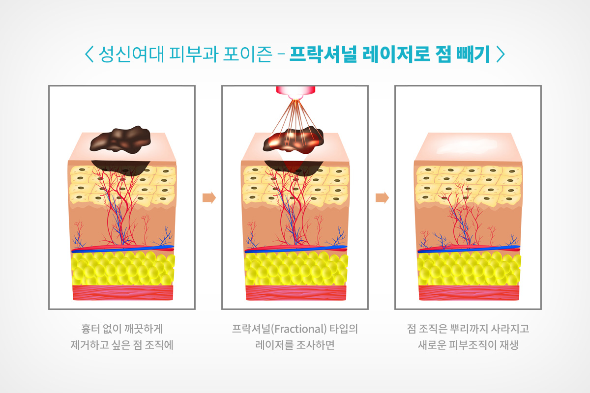 정릉피부과 04.jpg