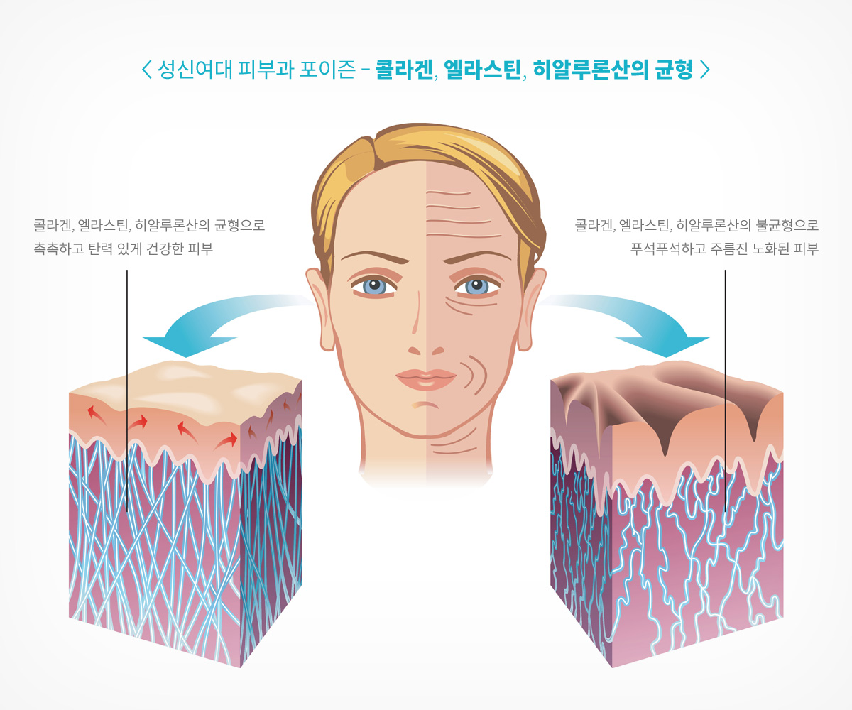 길음역피부과 성신여대포이즌 남자모공 (12).jpg