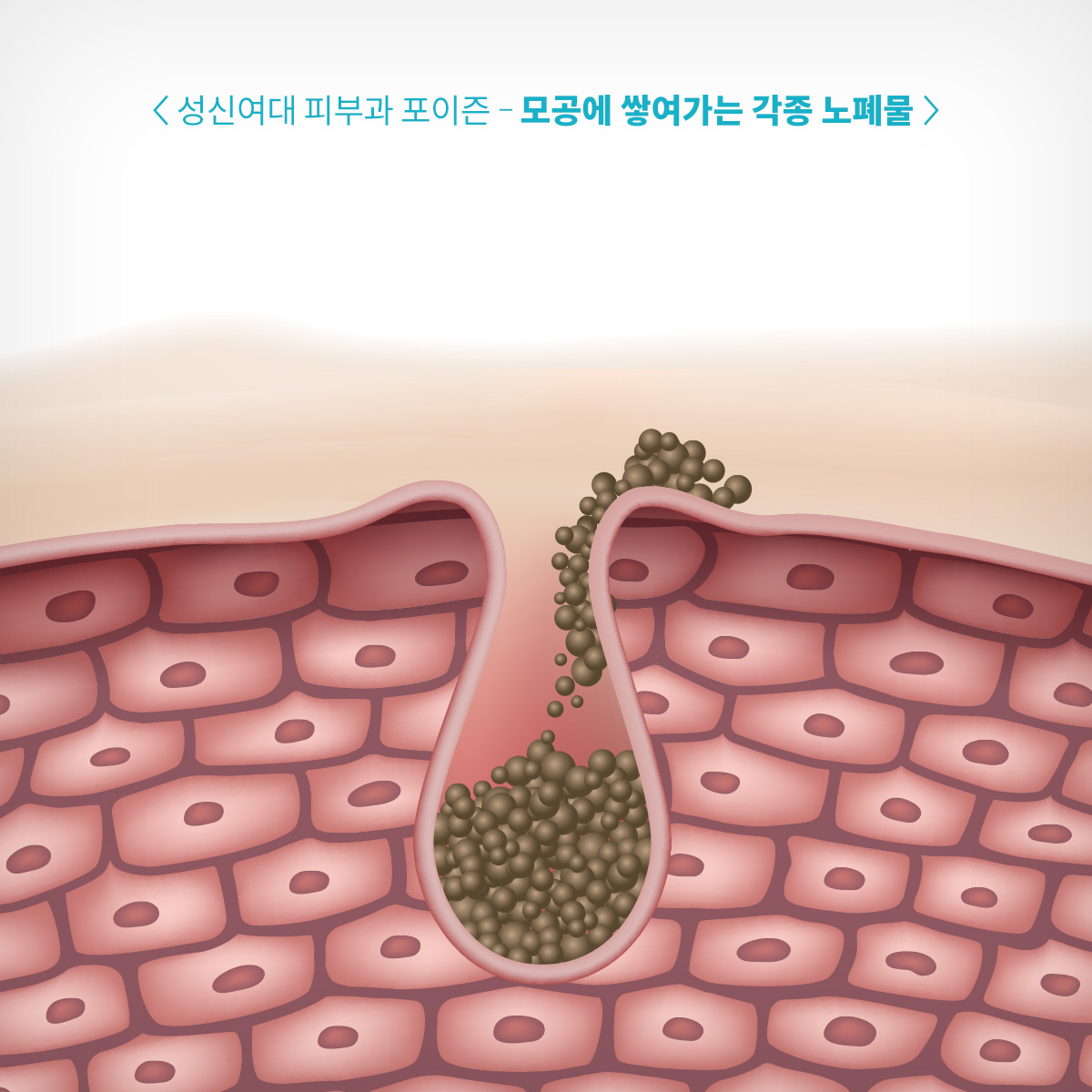길음역피부과 성신여대포이즌 남자모공 (6).jpg