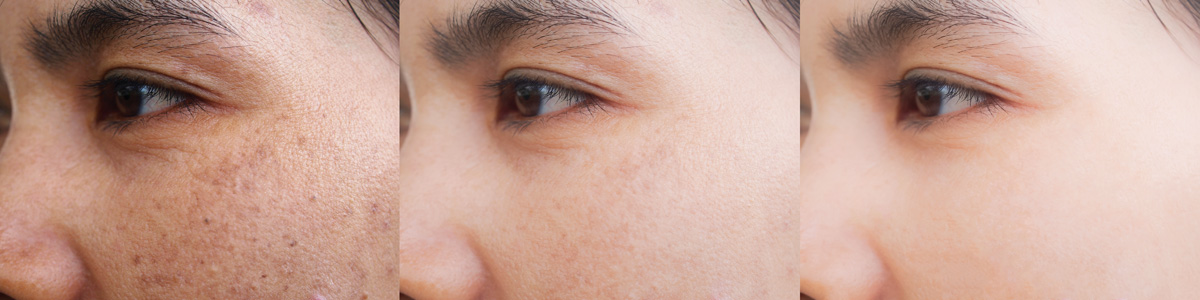 성신여대 피부과 11.jpg