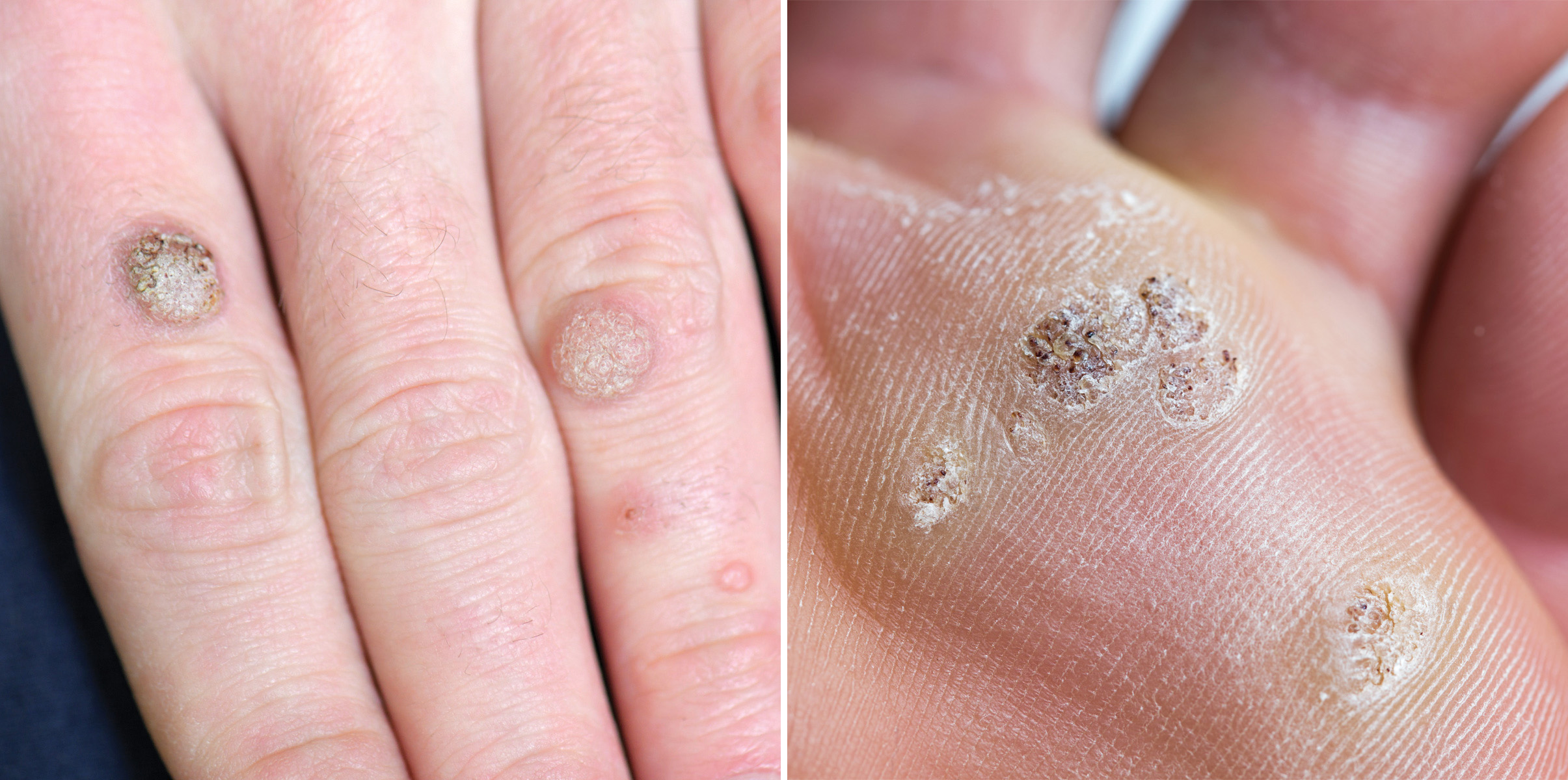 성북동 피부과 11.jpg