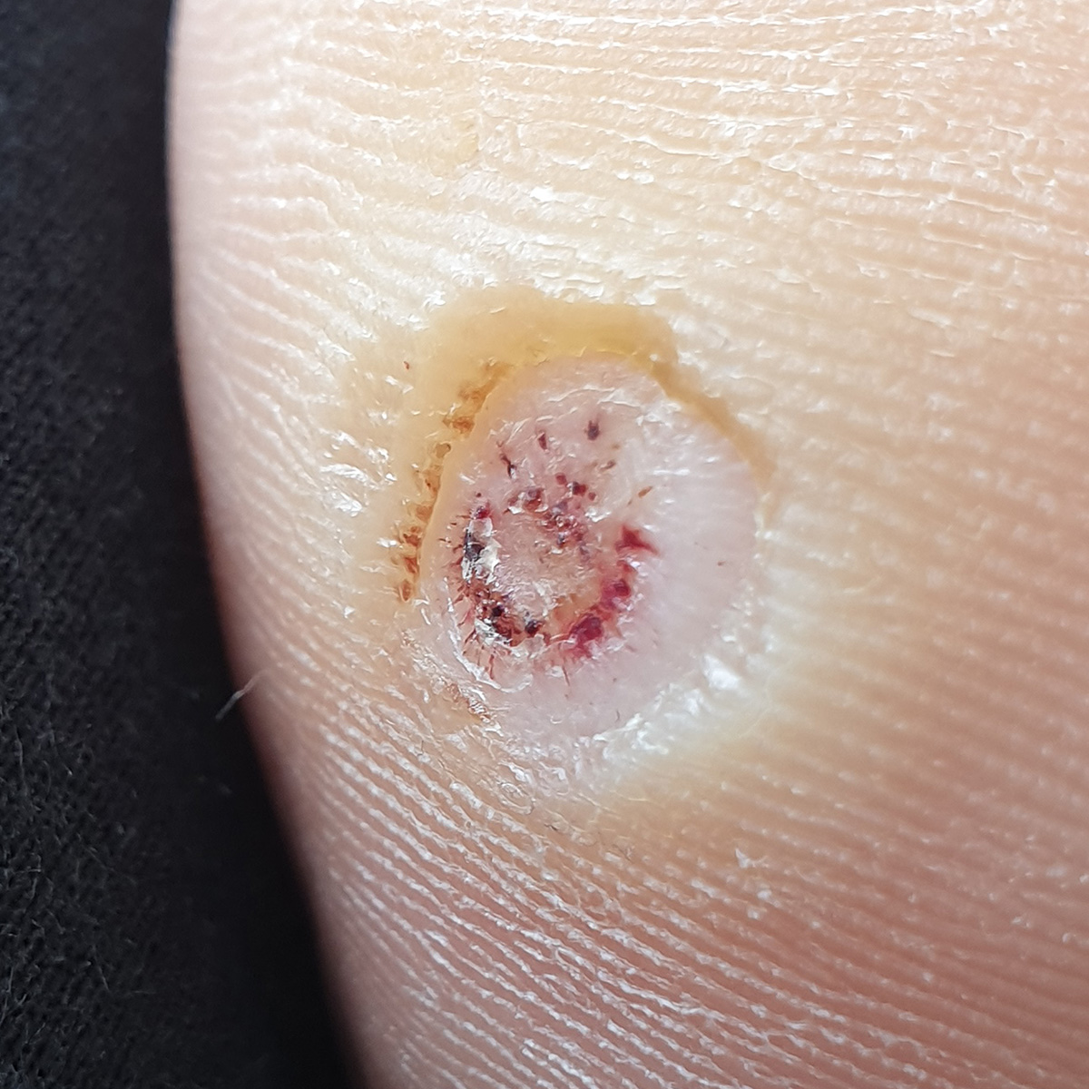 성북동 피부과 08.jpg