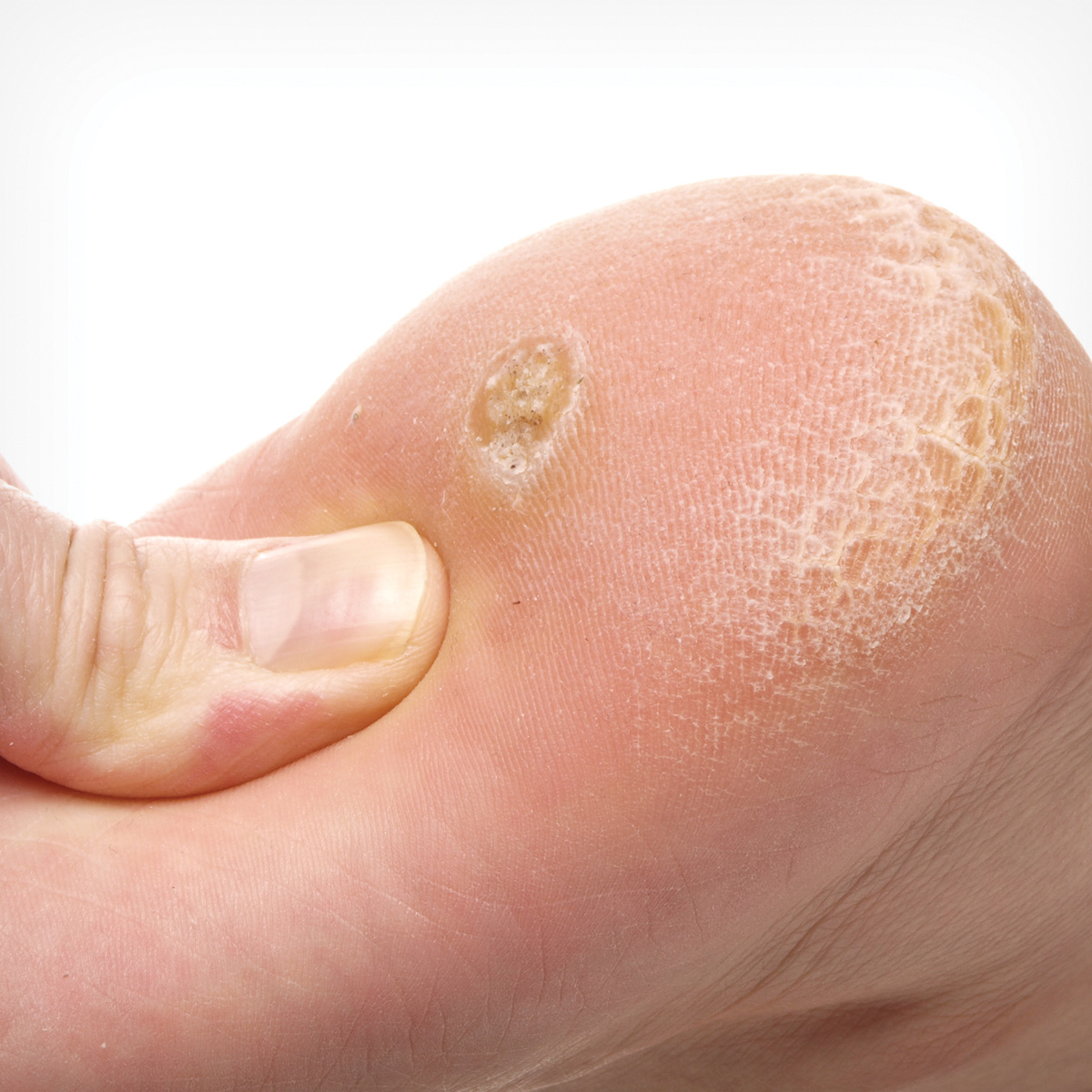 성북동 피부과 05.jpg