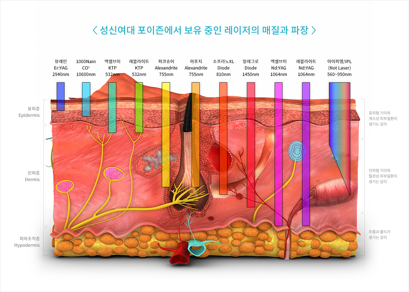고려대 피부과 성신여대입구역 포이즌 쥐젖 (13).jpg