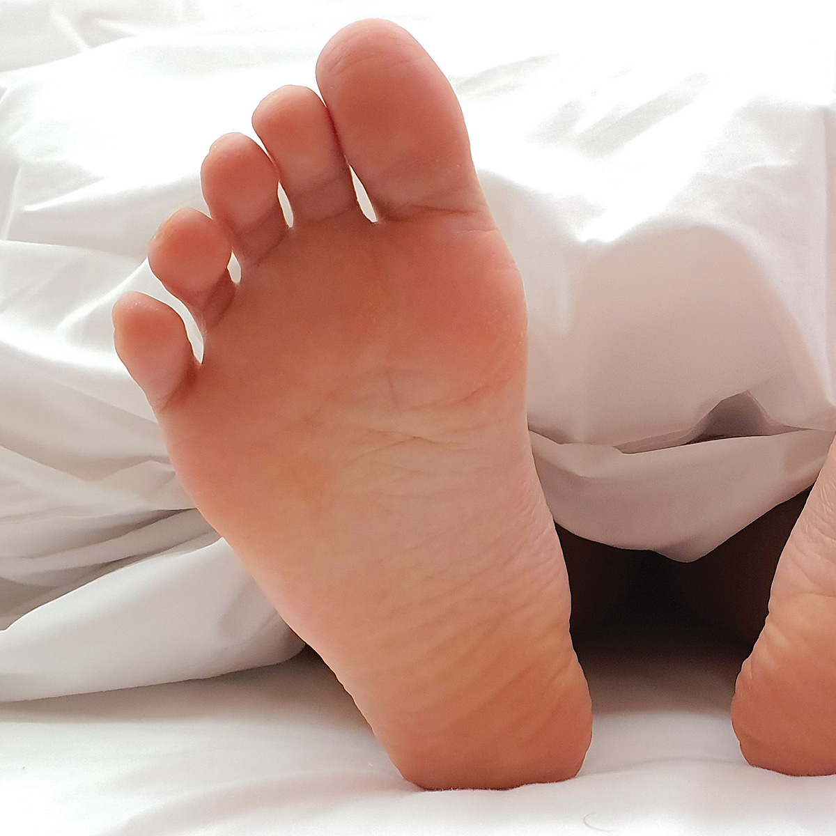 대학로피부과 발톱무좀 치료 (17).jpg