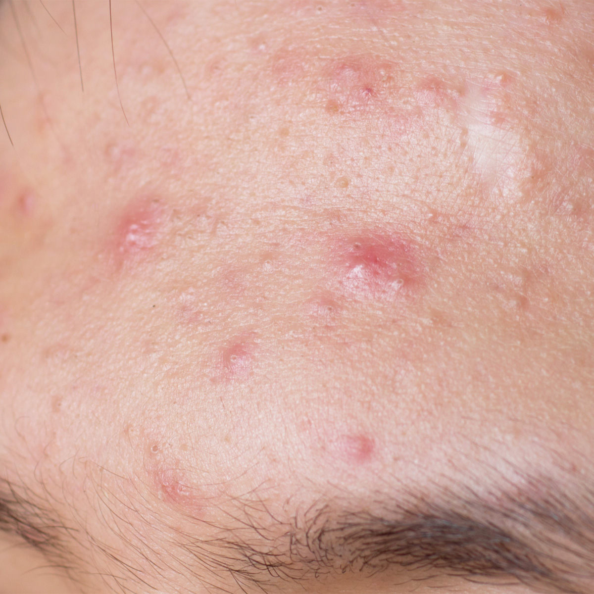 정릉역 피부과 01.jpg