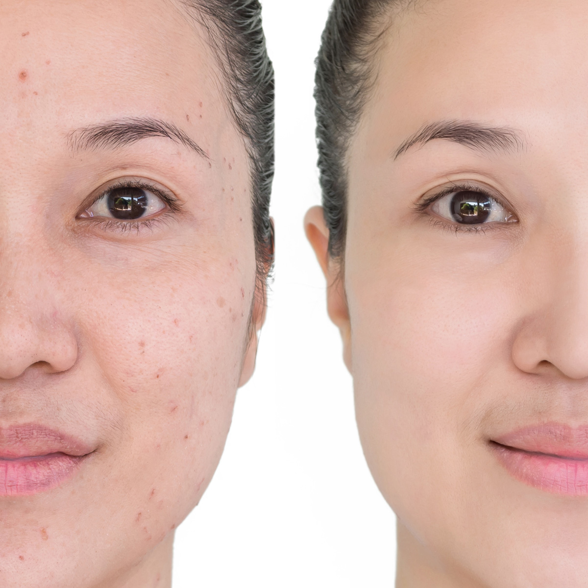 정릉역 피부과 09.jpg