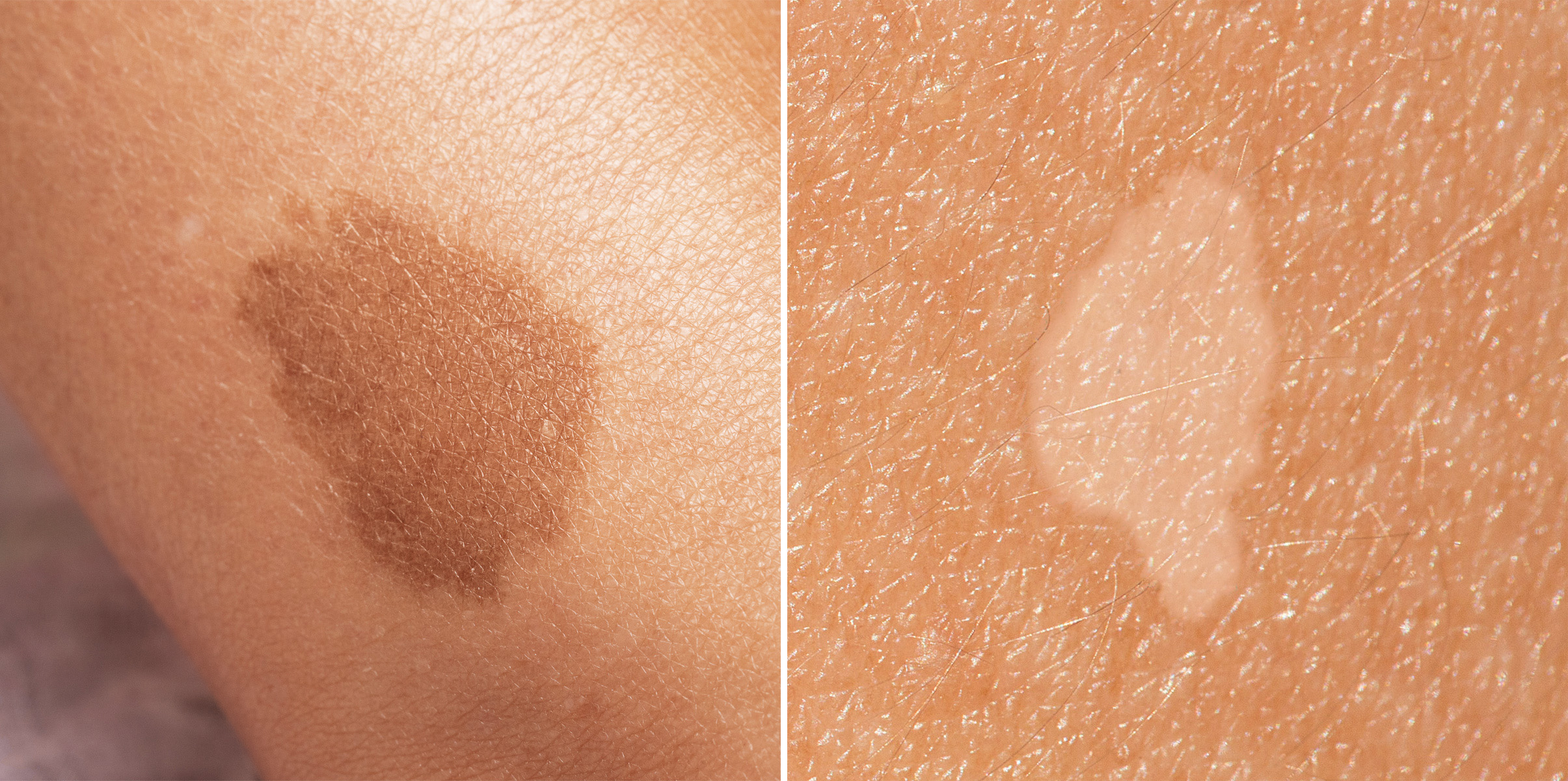 정릉역 피부과 05.jpg