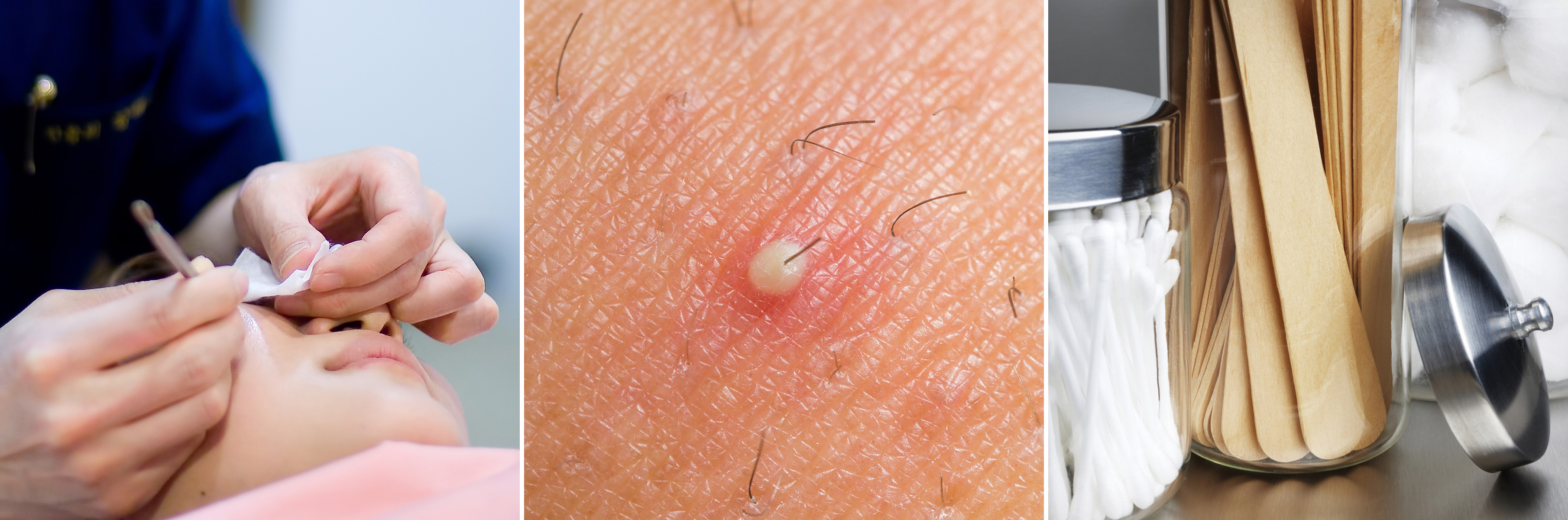 고려대피부과 10.jpg