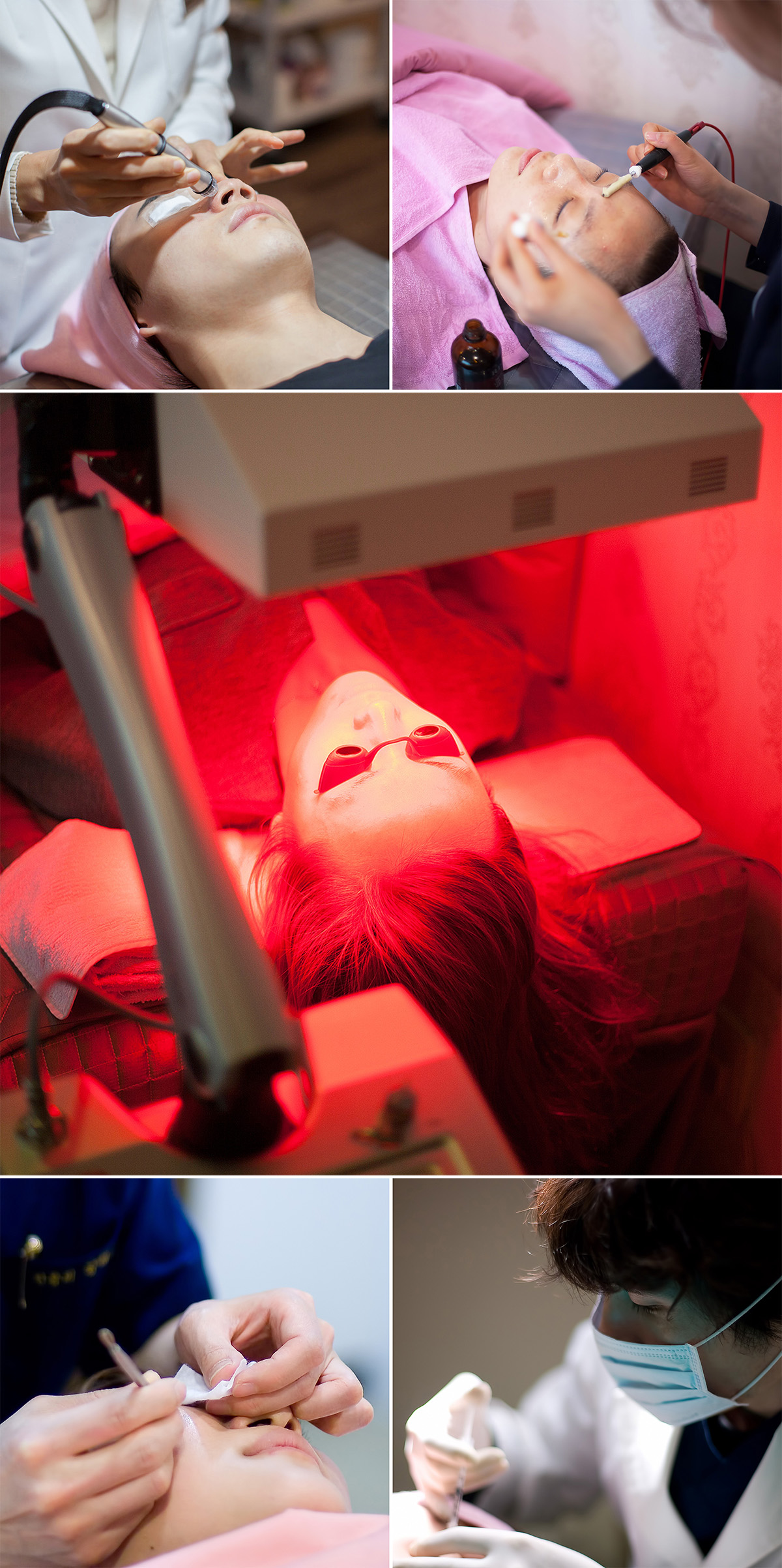 고려대피부과 13.jpg