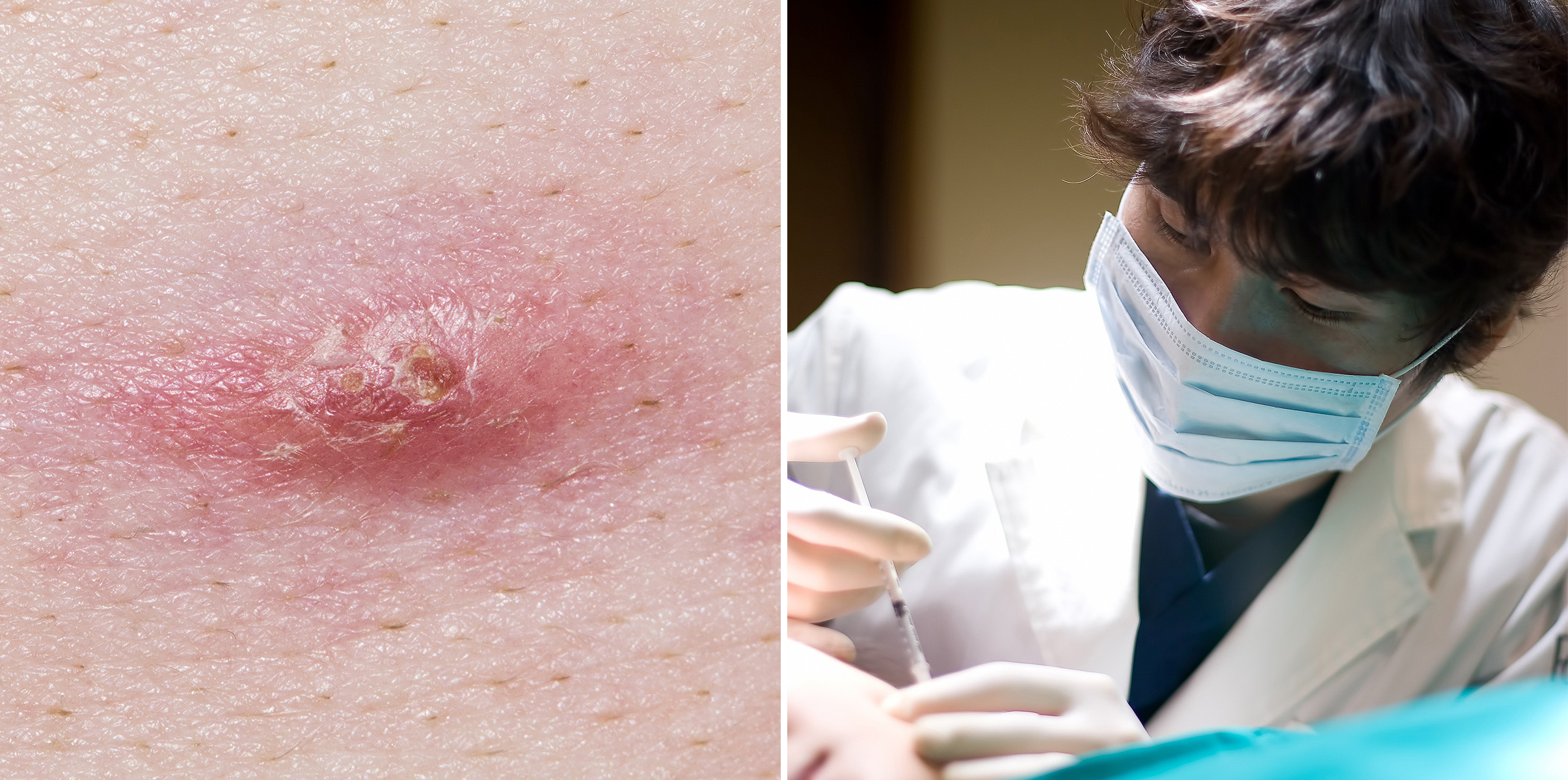 고려대피부과 11.jpg