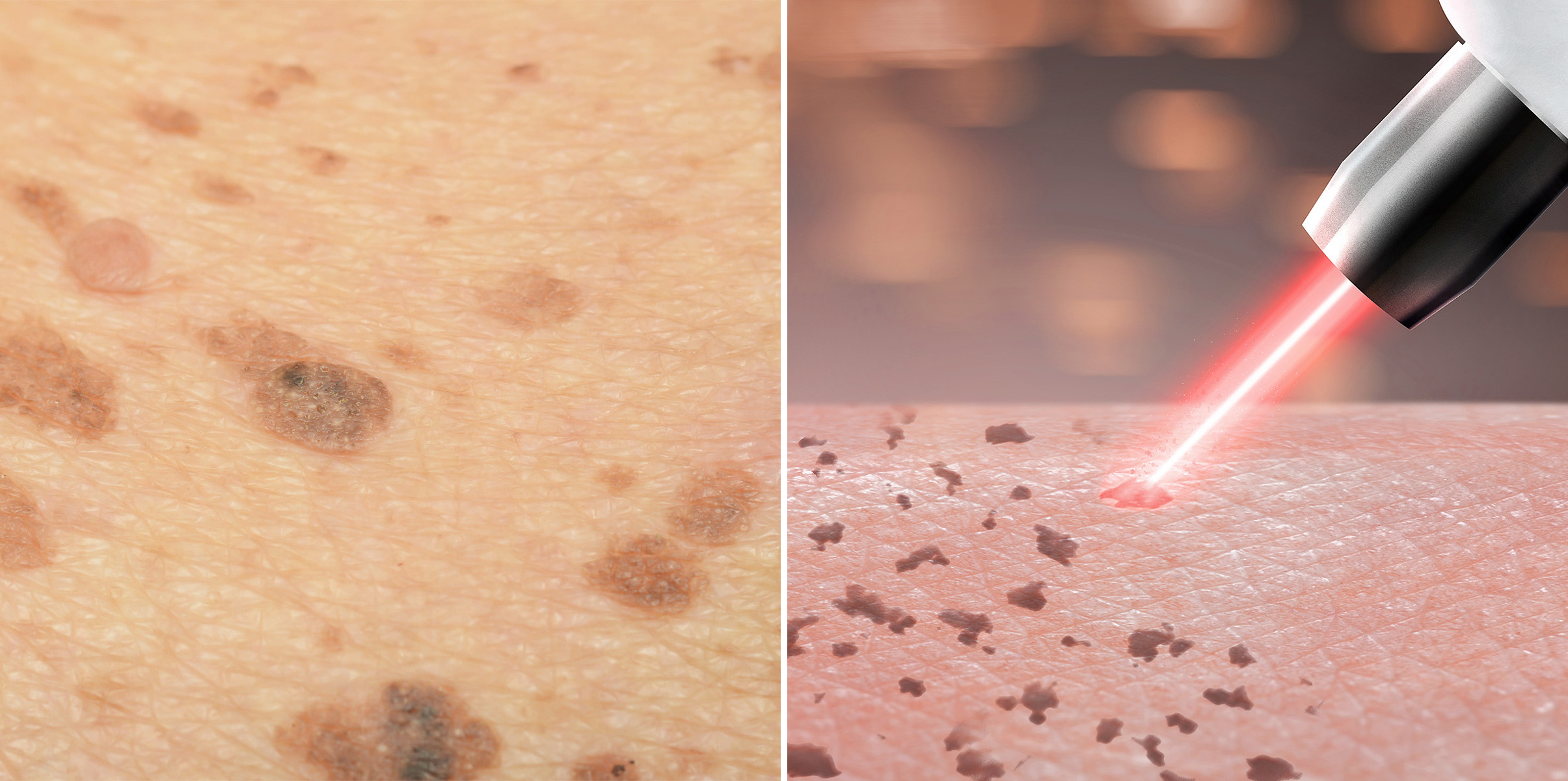 성신여대역 피부과 08.jpg