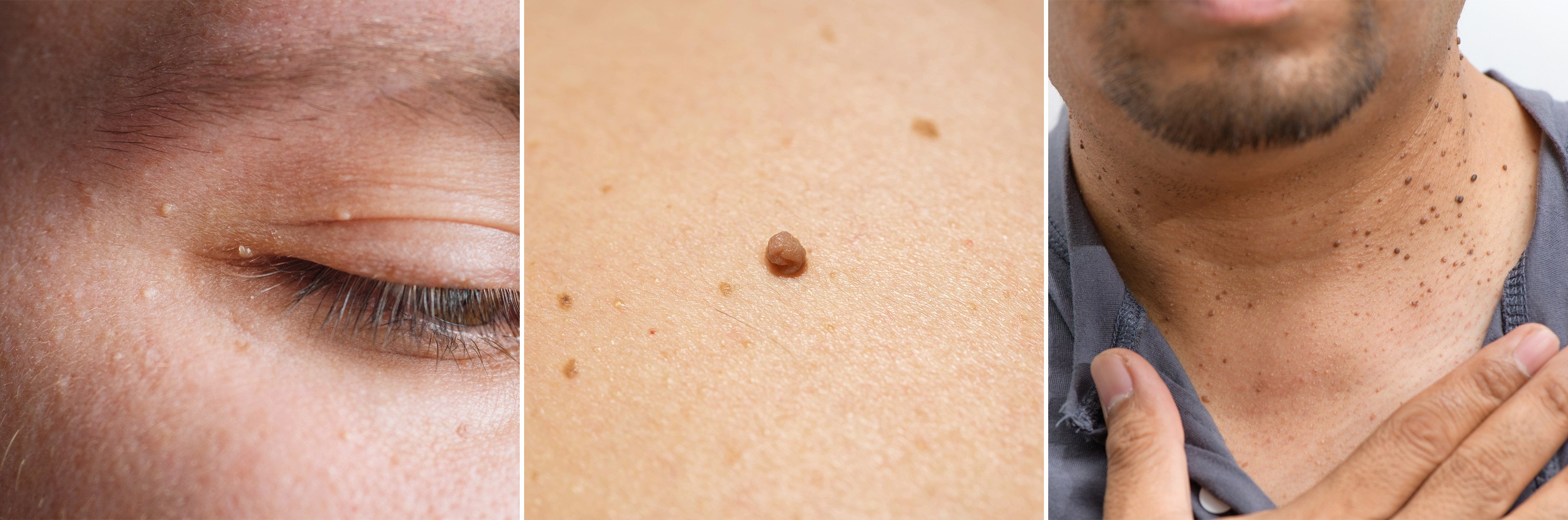 성신여대역 피부과 01.jpg