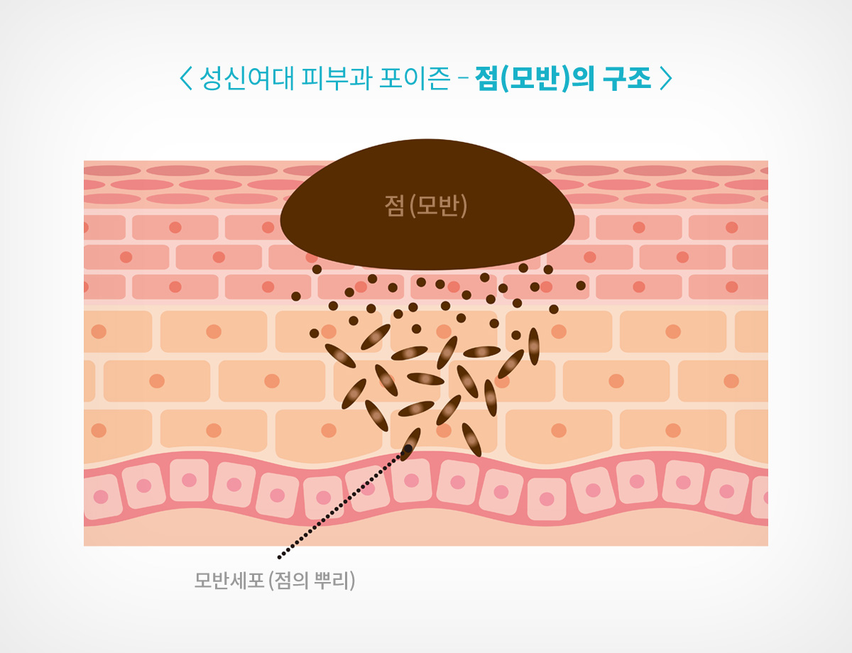 성신여대역 피부과 03.jpg