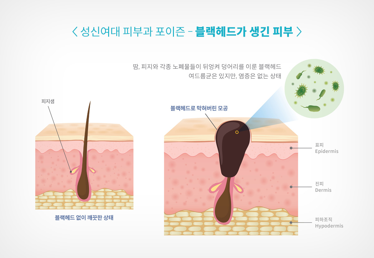 성신여대 피부과 04.jpg