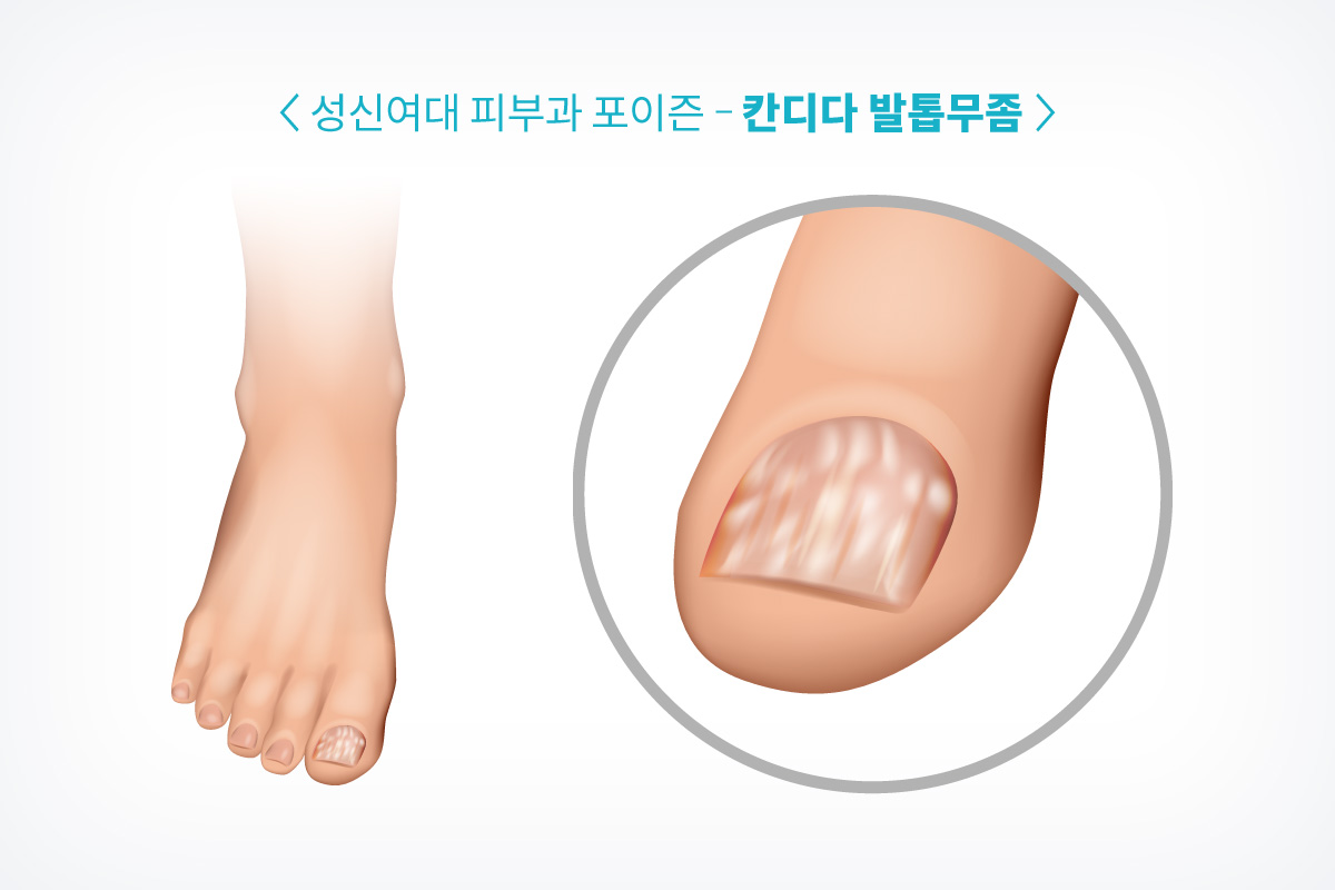 대학로피부과 12.jpg