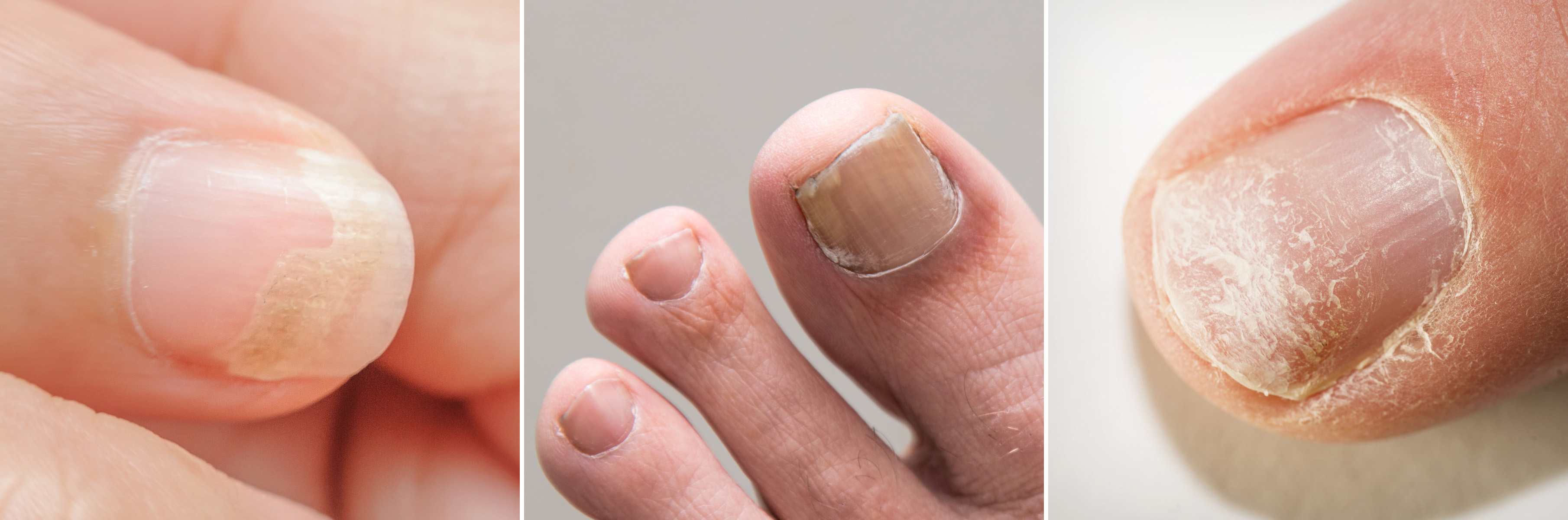 대학로피부과 11.jpg