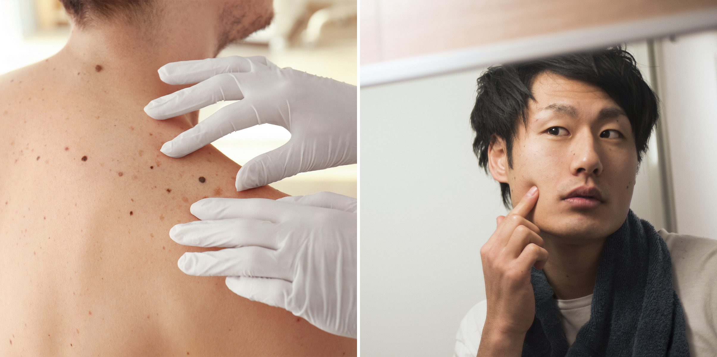 정릉 피부과 03.jpg